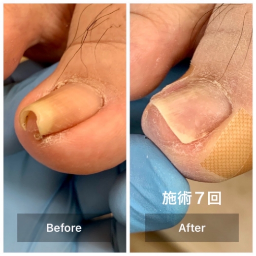 施術後